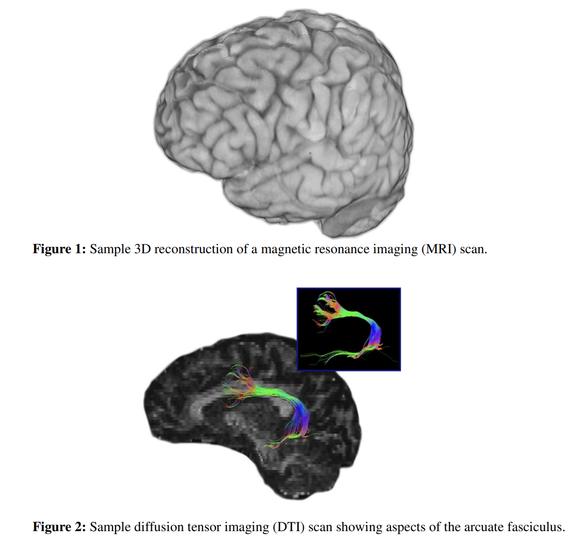 Figure 1,2