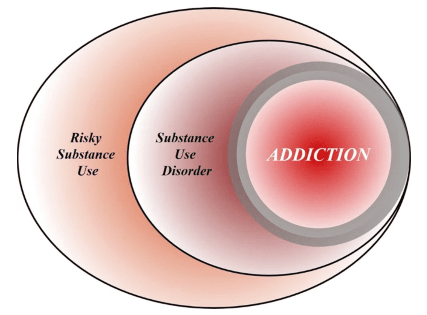 Fig. 1: A heuristic Venn diagram of the putative relationships among risky (hazardous) substance use, substance use disorder (SUD), and addiction.