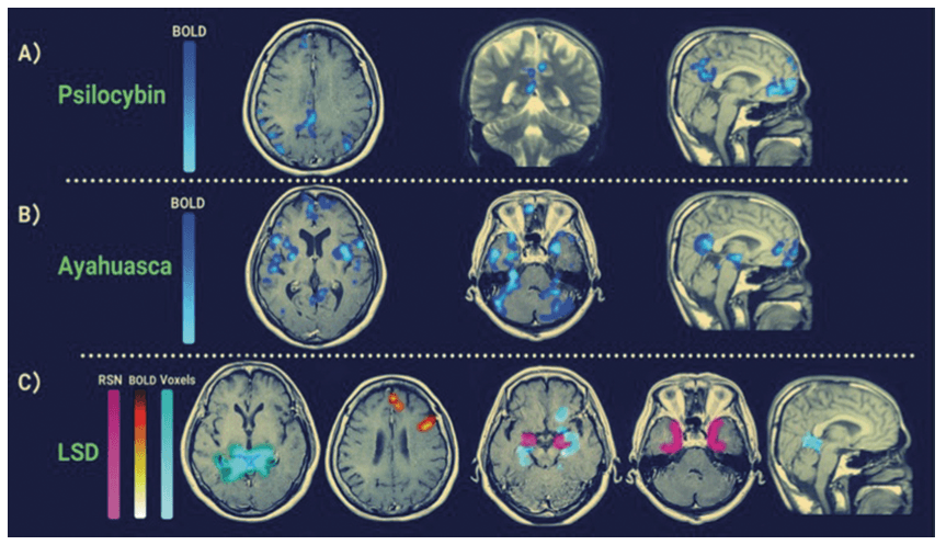 Figure 3.fMRI activity patterns of the various psychedelics on regions of the DMN.