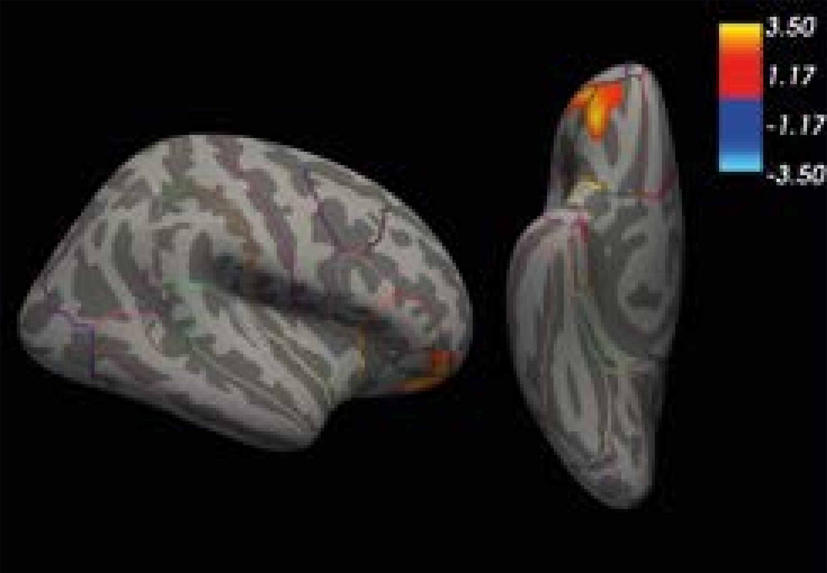 1889-1861-ejpalc-14-2-0093-gf02